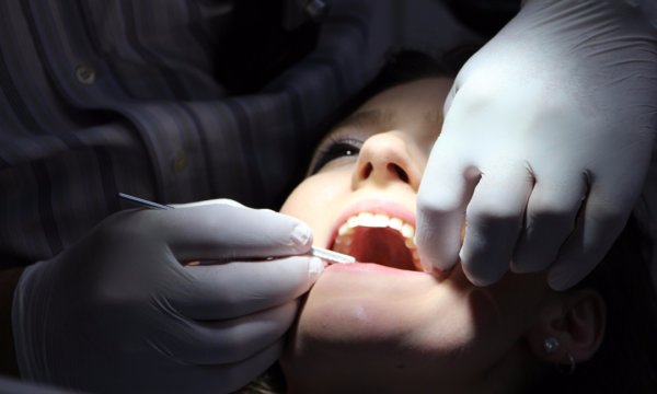 想要擁有一口潔白的牙齒？牙醫師：別被媒體催眠了，略帶黃色才健康