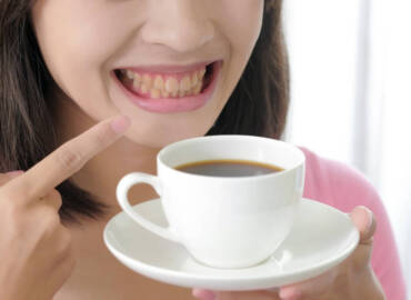 牙齒美白的選擇