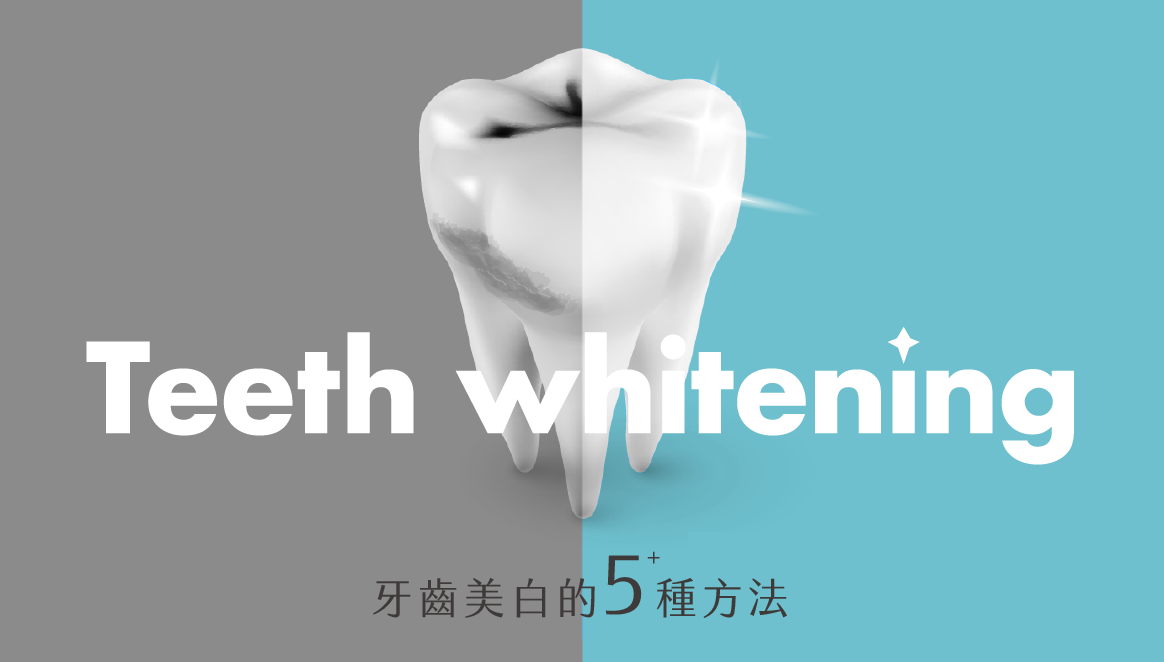 跟黃牙說再見！你應該知道的牙齒美白的5種方法