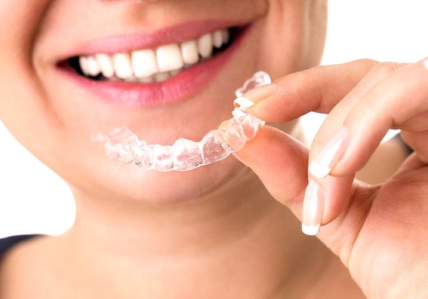 3D列印-數位牙科-牙齒矯正-隱形牙套-悅庭牙醫-台北