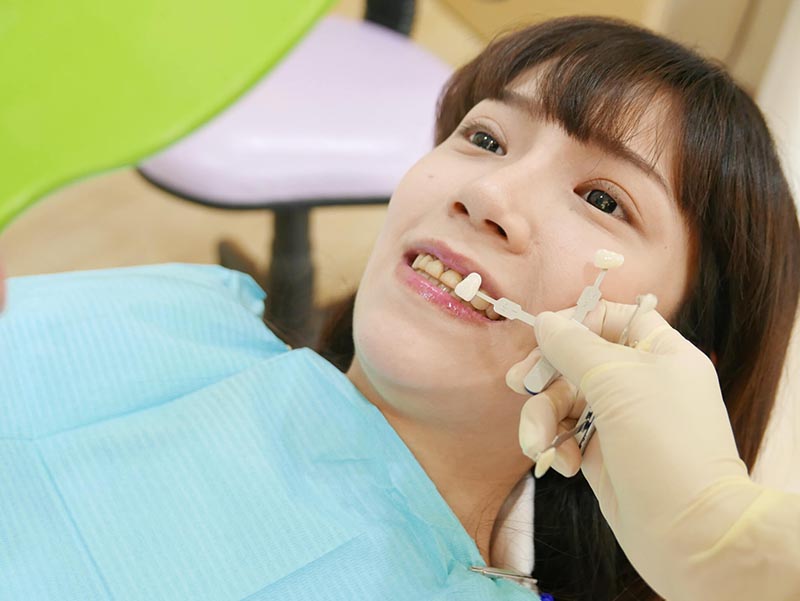 全瓷冠-瓷牙貼片-療程前-牙齒比色-悅庭牙醫-台北-穎穎