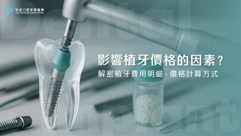 影響植牙價格的因素？解密植牙費用明細、價格計算方式