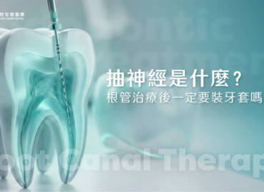 抽神經是什麼？根管治療後一定要裝牙套嗎？