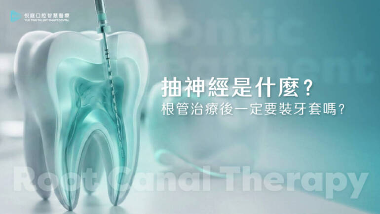 抽神經是什麼？根管治療後一定要裝牙套嗎？