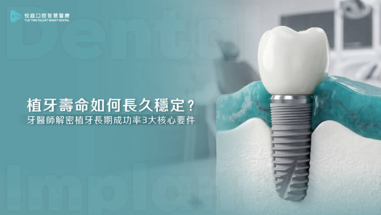 植牙壽命如何長久穩定？牙醫師解密植牙長期成功率3大核心要件