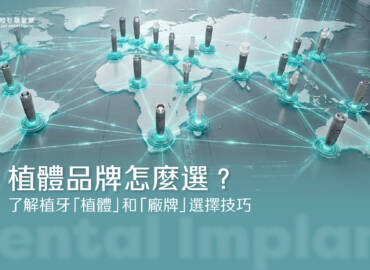 植體品牌怎麼選？了解植牙「植體」和「廠牌」選擇技巧