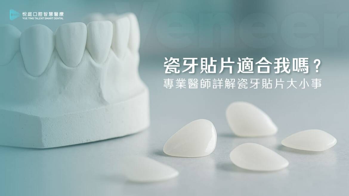 瓷牙貼片適合我嗎？專業醫師詳解瓷牙貼片大小事