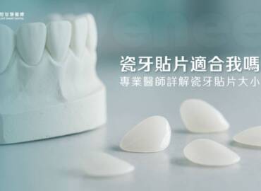 瓷牙貼片適合我嗎？專業醫師詳解瓷牙貼片大小事