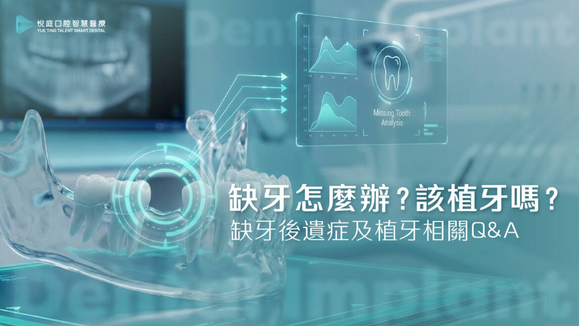 缺牙怎麼辦？該植牙嗎？缺牙後遺症及植牙相關Q&A