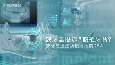 缺牙怎麼辦？該植牙嗎？缺牙後遺症及植牙相關Q&A