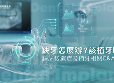 缺牙怎麼辦？該植牙嗎？缺牙後遺症及植牙相關Q&A