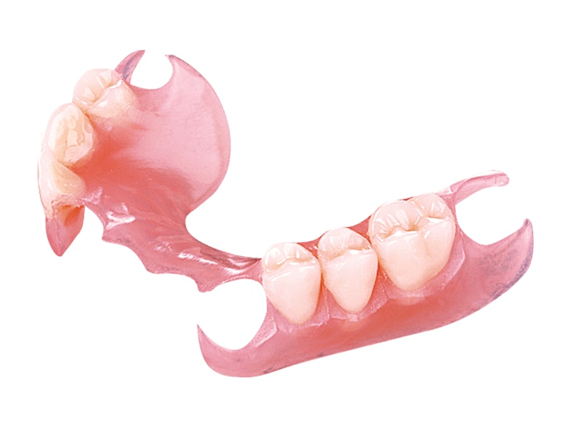 活動假牙-假牙種類-局部活動式假牙-彈性軟床-悅庭牙醫-台北牙醫推薦
