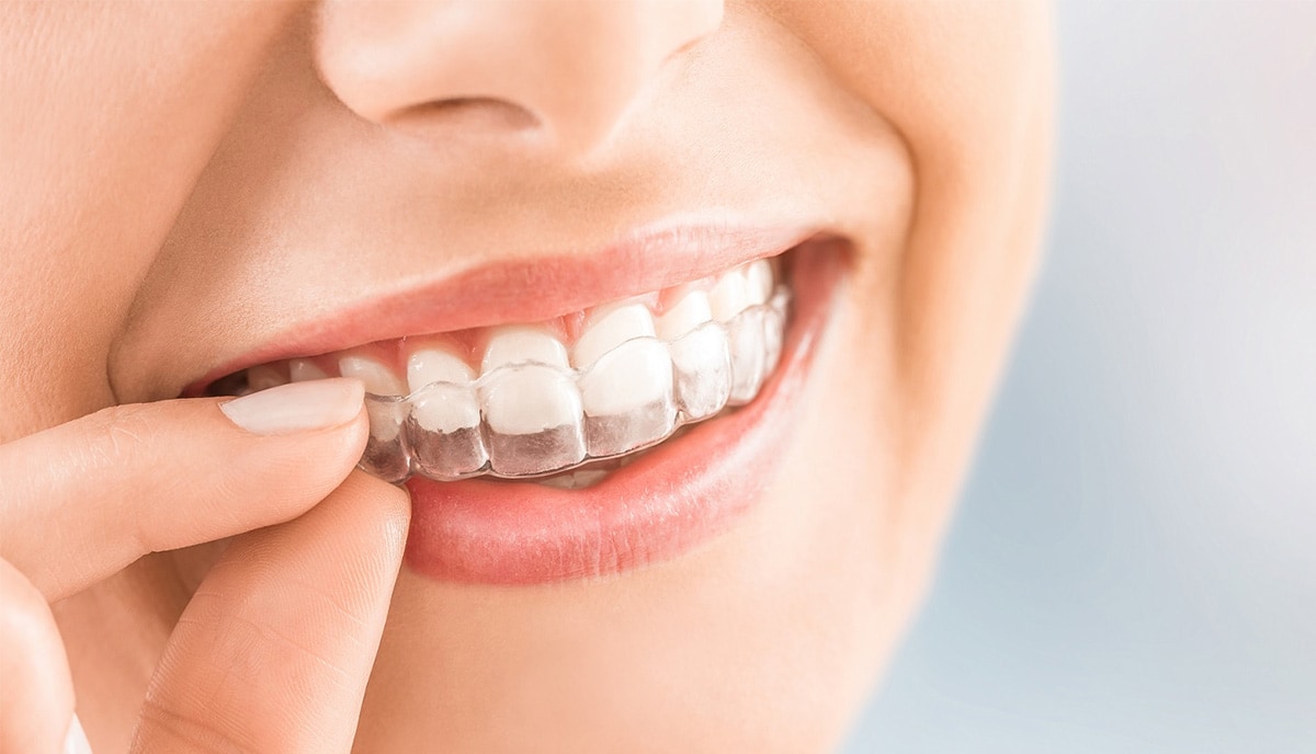 磨牙-咀嚼肌治療-防磨牙軟式咬合板-悅庭牙醫-台北牙醫推薦