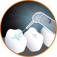 雷射治療應用-兒童牙科-台北牙醫-悅庭牙醫