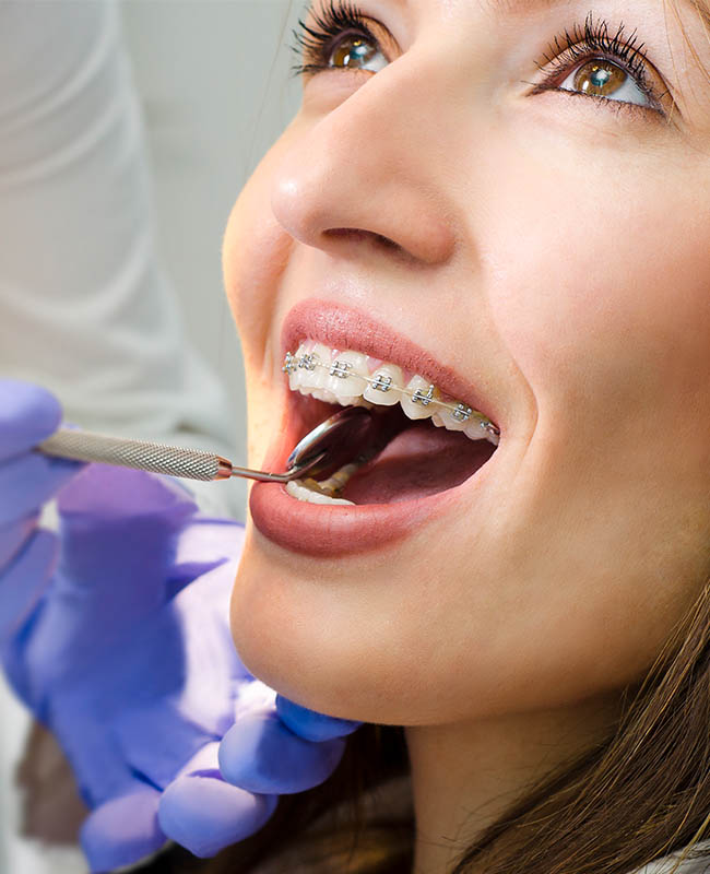 齒顎矯正科-牙齒矯正-隱形矯正-悅庭牙醫-台北牙醫推薦