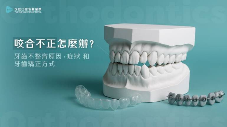 咬合不正怎麼辦？牙齒不整齊原因、症狀和牙齒矯正方式