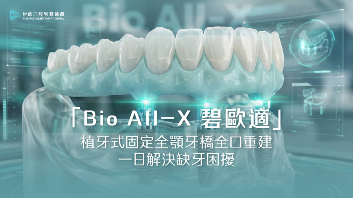 「Bio All-X 碧歐適」植牙式固定全顎牙橋全口重建，一日解決缺牙困擾