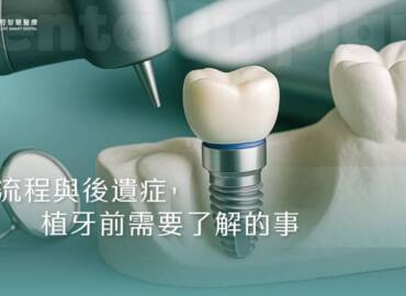 流程與後遺症，植牙前需要了解的事