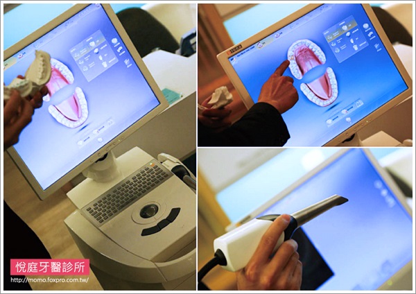 TCI舒眠牙醫-導引式植牙-台北-悅庭牙醫-全口攝影口內取像儀-1-momo