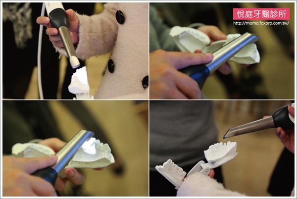 TCI舒眠牙醫-導引式植牙-台北-悅庭牙醫-全口攝影口內取像儀-5-momo