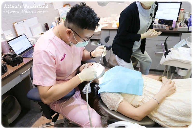 牙齒美白-居家美白-台北-悅庭牙醫-牙模製作中-Nikkie