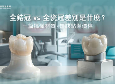 【2026最新比較指南】全鋯冠 vs 全瓷冠差別是什麼？一篇搞懂材質、優缺點與價格