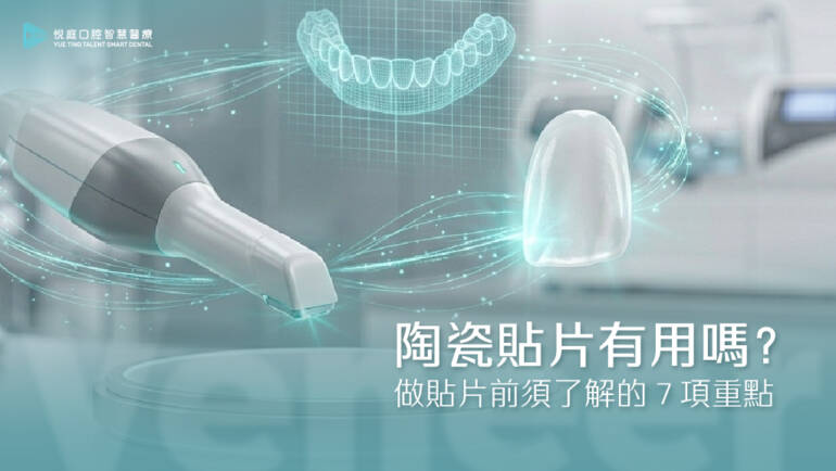 瓷牙貼片有用嗎？做貼片前須了解的７項重點