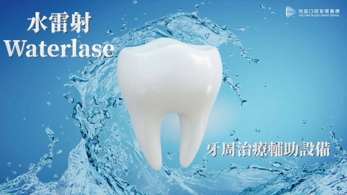 水雷射（Waterlase）－牙周病治療輔助設備