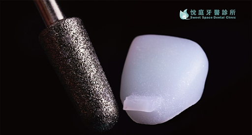 圖／「悅庭牙醫診所」採用鑽石細針進行牙齒修磨。
