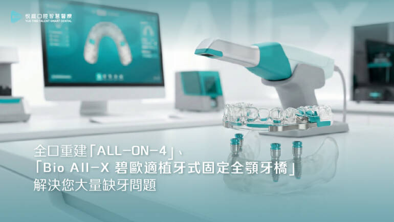 全口重建「ALL-ON-4」「BIO-ALL-X 碧歐適植牙式固定全顎牙橋」解決您大量缺牙問題