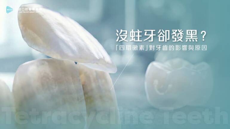 牙齒灰黃、有牙縫怎麼救？從 40 歲特助的「四環黴素牙」重建案例，看懂為什麼「陶瓷修復」是唯一解法