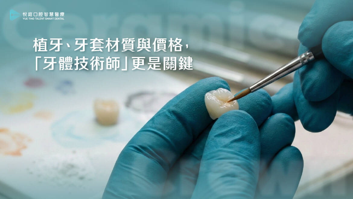 植牙、牙套材質與價格，「牙體技術師」更是關鍵
