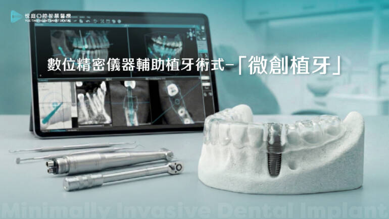 數位精密儀器輔助植牙術式－「微創植牙」
