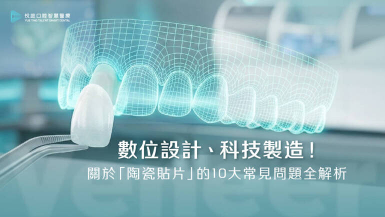 數位設計、科技製造！關於「陶瓷貼片」的10大常見問題全解析(2024.08更新)