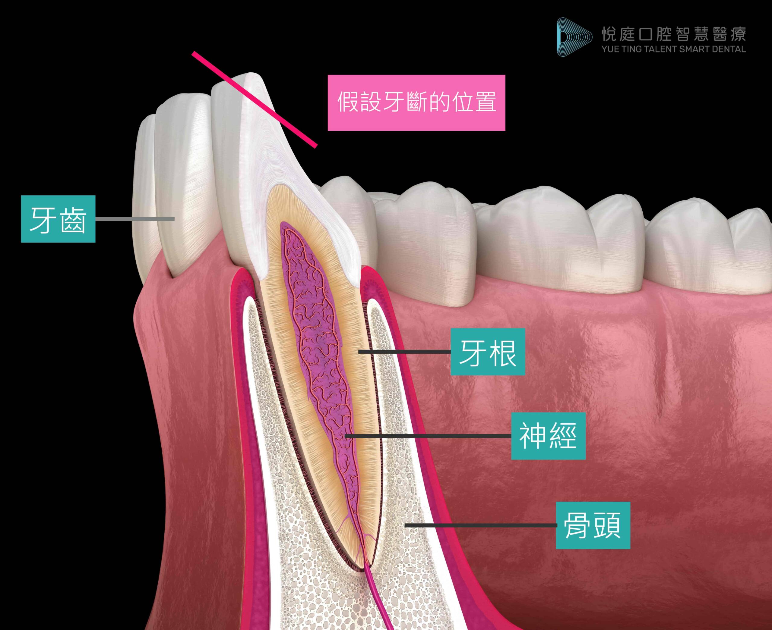圖／牙齒的構造剖面