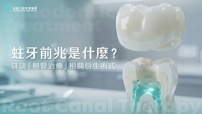 蛀牙前兆是什麼？詳談「根管治療」相關衍生術式。