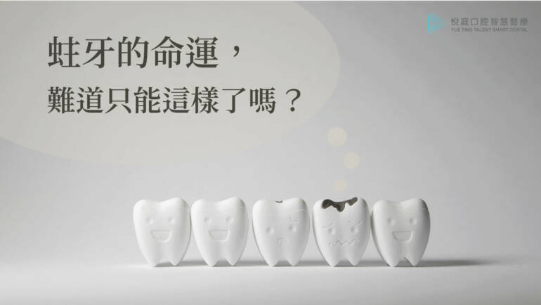蛀牙只剩拔牙？詳談「根管治療」相關衍生術式。