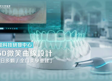 做完多顆假牙死白又假?一日全口美學重建費用、DSD微笑曲線與名模案例全解析