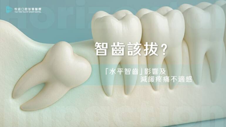 智齒該拔？「水平智齒」影響及減緩疼痛不適感