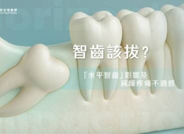 智齒該拔？「水平智齒」影響及減緩疼痛不適感