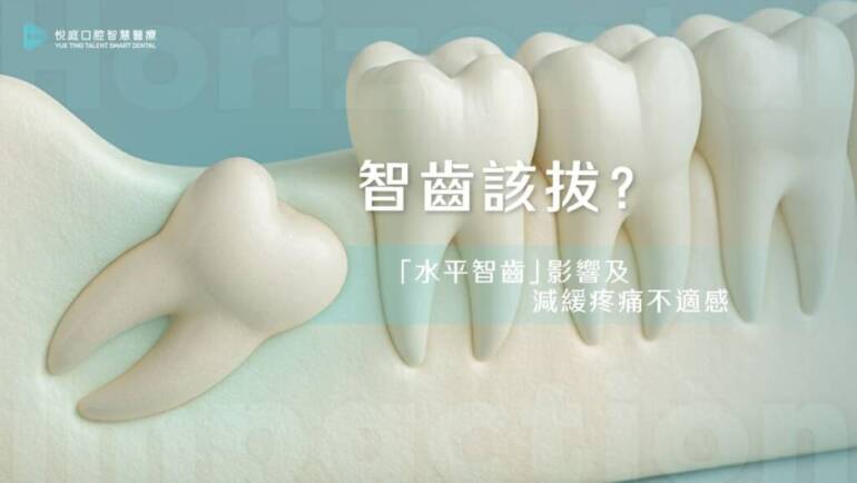 智齒該拔？「水平智齒」影響及減緩疼痛不適感