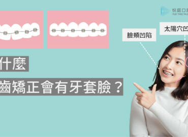 為什麼牙齒矯正會「牙套臉」？４種預防面部運動