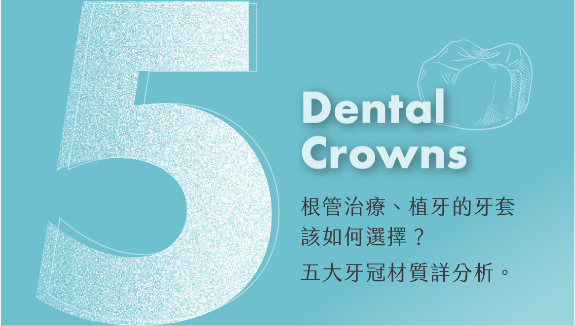 根管治療、植牙的牙套該如何選擇？五大牙冠材質詳分析