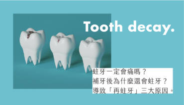 蛀牙一定會痛嗎？補牙後導致「再蛀牙」的3大原因