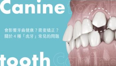 會影響牙齒健康？需要矯正？關於４種「虎牙」常見的問題