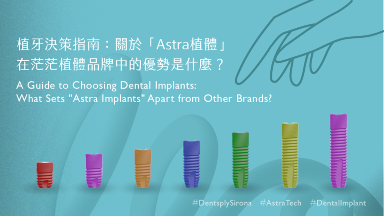 植牙決策指南：關於「Astra植體」在茫茫植體品牌中的優勢是什麼？