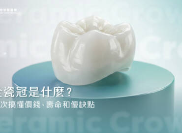 全瓷冠是什麼？一次搞懂價錢、壽命和優缺點。