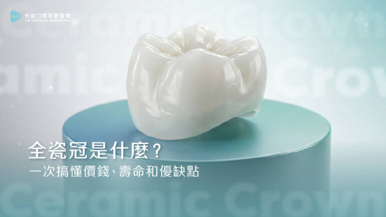 全瓷冠是什麼？一次搞懂價錢、壽命和優缺點。