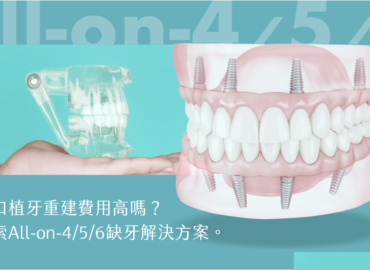 全口植牙重建費用高嗎？探索All-on-4/5/6缺牙解決方案