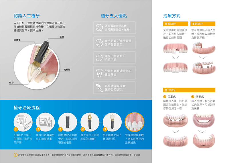 植牙優點、流程與治療方式設計示意圖